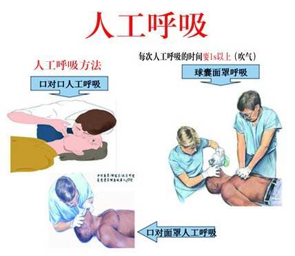 人工呼吸:口对口人工呼吸送气时捏住患者鼻翼,呼气时松开,送气时间