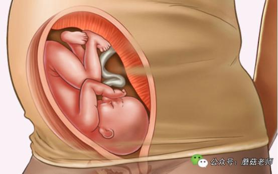 所以入盆的时间也具有早晚的情况,一般大约在怀孕36周后,胎儿头部开始