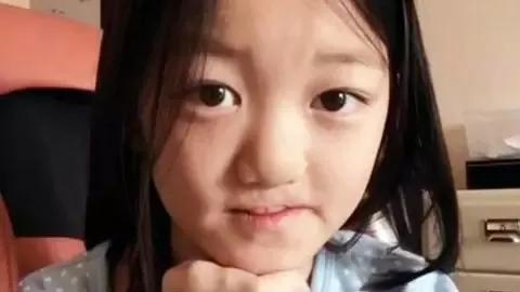 其实李嫣的兔唇早在母亲肚子里时就被检查出来了.李亚鹏