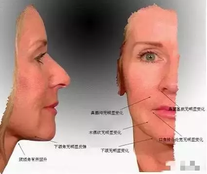 a8n8pd4725014483855.png