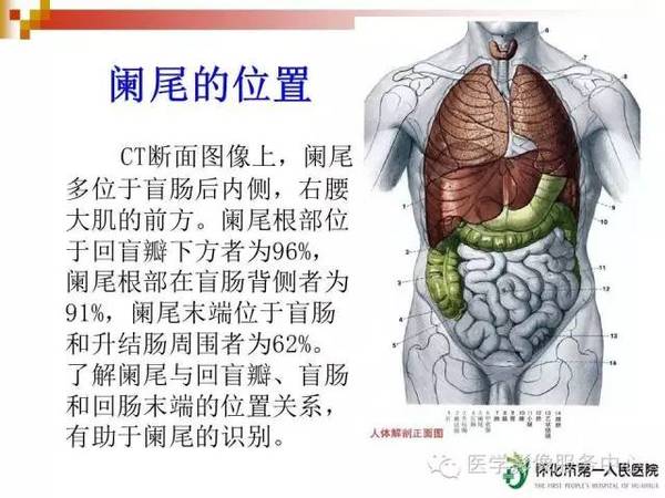 急性阑尾炎的ct诊断,简单易懂!