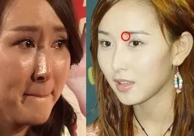 女人身上难得的几处好痣相,富贵不用愁!