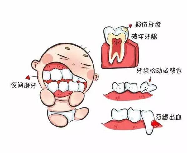 原来宝宝睡觉磨牙,不仅仅是惊到麻麻那么简单