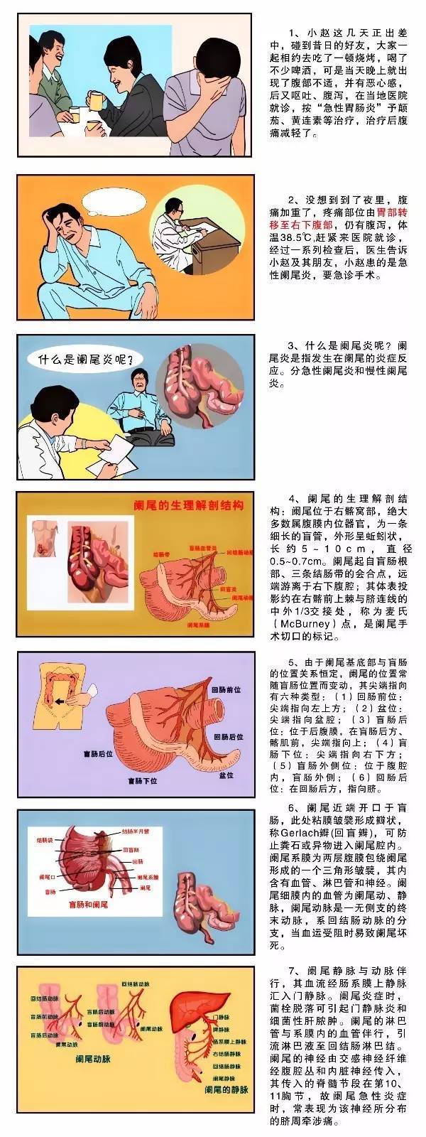 图解疾病:阑尾炎-健康频道-手机搜狐
