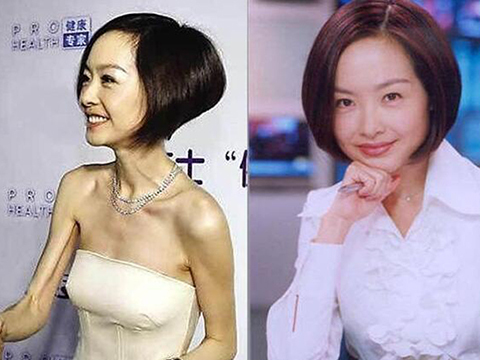 美容那些瘦成"排骨胸"的女明星,盘点不瘦胸减肥瘦身花草茶图片