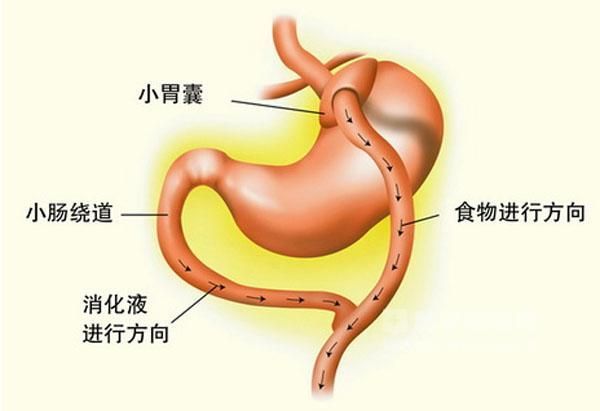 甩甩瘦减肥有用吗_爱瘦国际减肥是不是有圈套_秀瘦国际减肥我想加盟