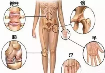 指关节肿胀疼痛 人体关节肿胀但无痛是什么原
