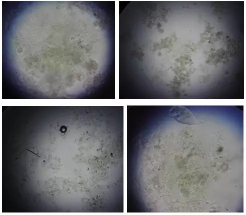 【图谱·下】说说活性污泥微生物镜检(下)之运行