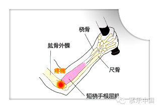 a49xcl99662717113.jpeg