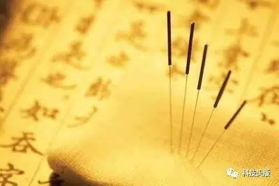 【表示不服】世界卫生组织都认可了 针灸咋就成了