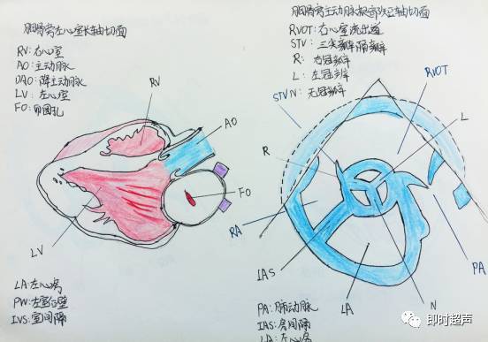 一 胸骨旁左心室长轴切面 二 胸骨旁主动脉根部短轴切面