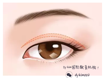 开眼角对眼睛有伤吗 a4y6gr7661062104946.jpg