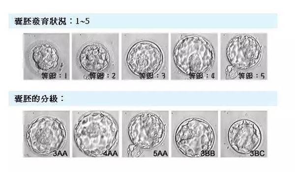 (第五天的囊胚) 内细胞团分级: a级,细胞数目多,排列紧密; b级,细胞