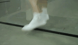 如果自己活动足踝时有剧痛 不能持重站立和挪步 疼的地方在骨头上 应