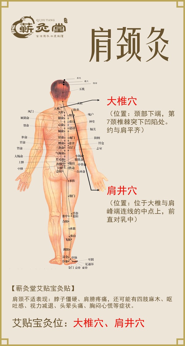 艾贴宝为您推荐,艾灸怎么治疗肩颈痛