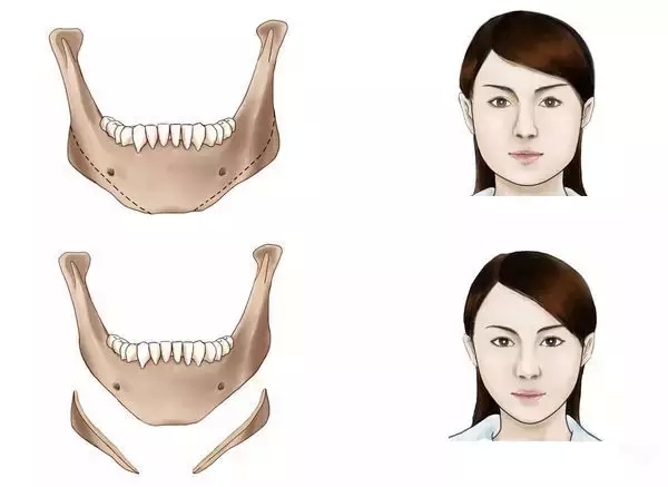 项链和脸型怎么搭_黄金项链图片(2)