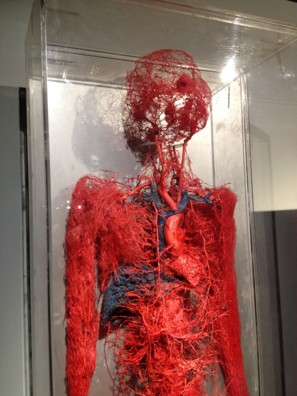 你见过人体血管的全貌吗 是这个样子
