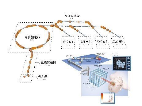 质子重离子——最先进的肿瘤放射治疗技术