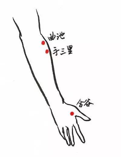 以曲池,手三里,内关,阳溪,合谷,阿是穴(局部痛点)及桡骨茎突部(列缺)