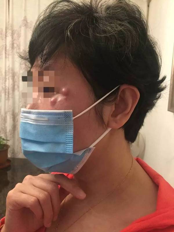 民生热线 美容变毁容