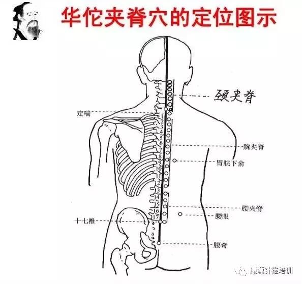 久治不愈的慢性疾 ,可向"华佗夹脊穴"求助