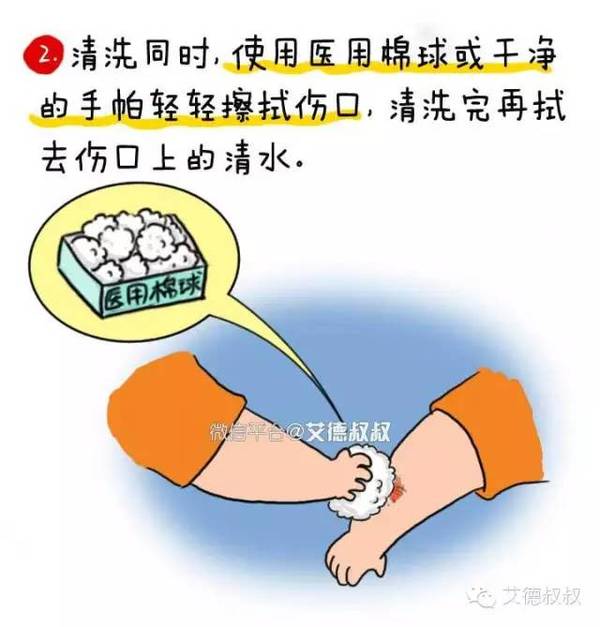 意外伤口不可怕,可怕的是你不会处理!