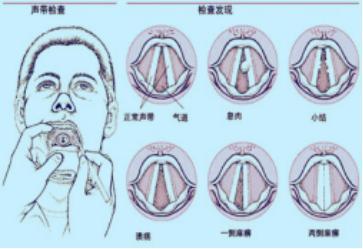 耳朵里面呼呼响是怎么回事