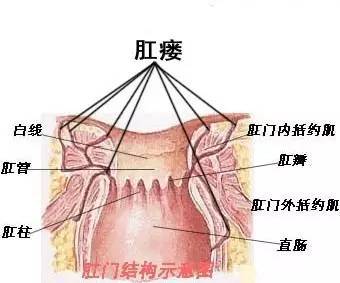 有可能是肛瘘!