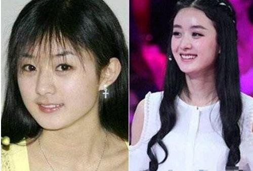 哪些明星的对比惊艳到你了呢,一起说说吧 (如果不知道肌肤如何有效