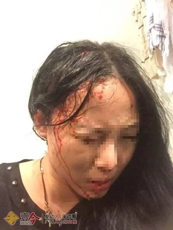可怕!三名广西人在南非旅游遭劫匪枪击,一对母女头部中枪!