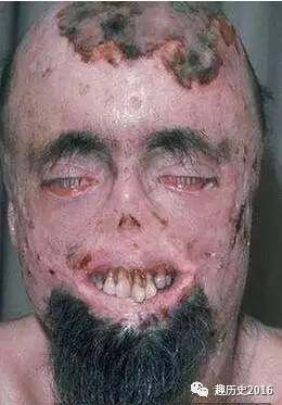 有研究认为传说中的吸血鬼有可能与狂犬病有关,理由是相当多的症状
