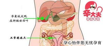 着床成功后出血图片