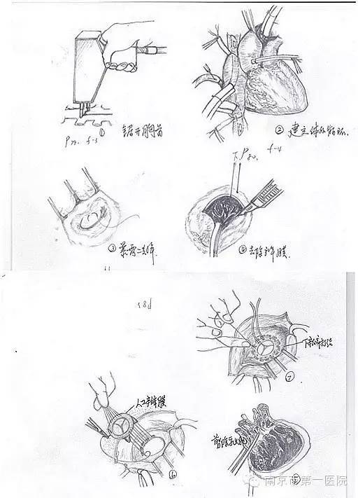 "南京好人365":画图医生让患者心定