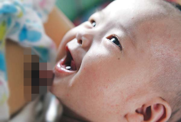 注意力不集中吃什么中成药 a178hp1583317729296.jpg