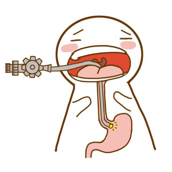 肠镜  