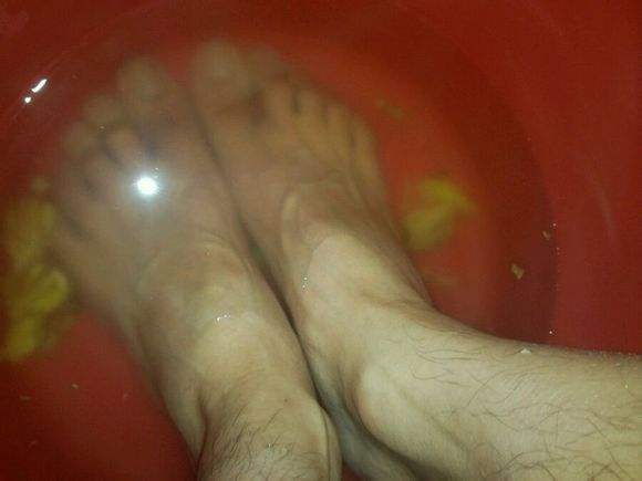 v水泡失眠水泡3:偏方醋生姜脚qq版鱼丸游戏下载图片