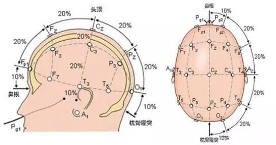 普通头皮脑电图,我们采用国际10-20系统,第一,电极位置的排列与头颅