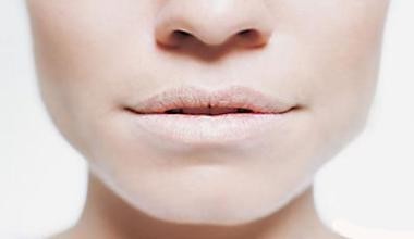 唇什么什么白成语_成语故事简笔画(2)