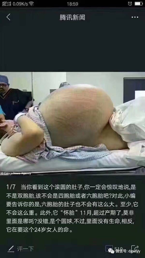 a57efd8345221719619.jpeg