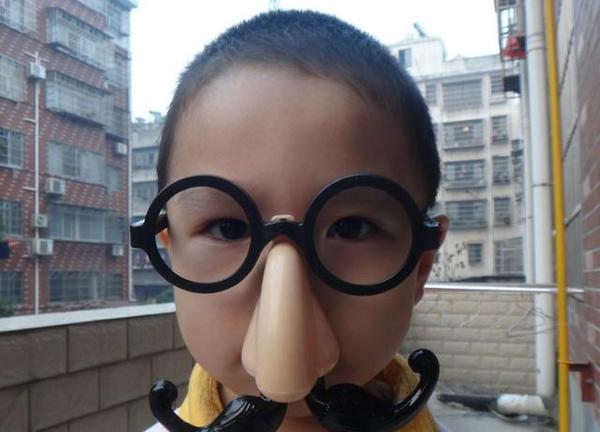 四岁的小女孩居然长出了个大鼻子