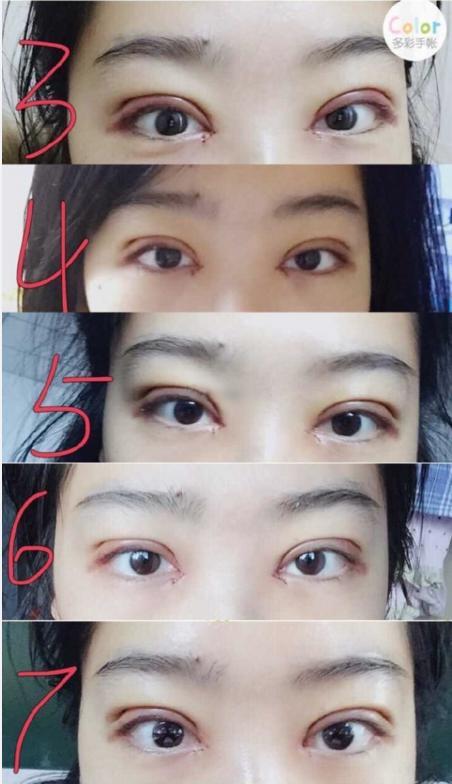 开了双眼皮第一次撸妆,效果惊人