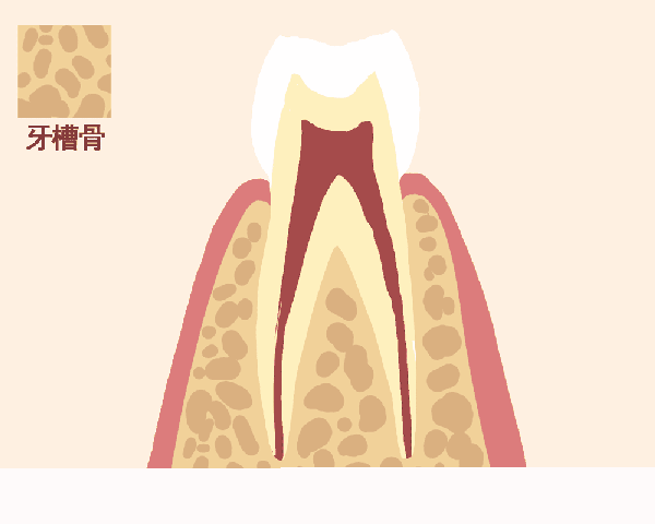 一张图片告诉你!