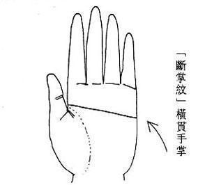 人口断掌比例_断掌图片