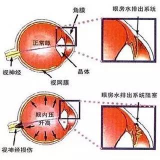 易感人口_易感人群图片(2)