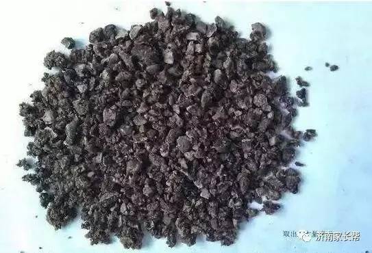 两岁孩子长13mm的肾结石,原因竟是我们经常吃的这种食物