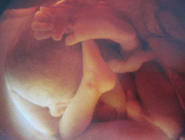 几个月胎儿在肚子里会动了 a2p6ne26738311319405.jpg