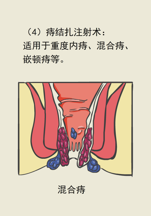 a5s89a7367102224619.png