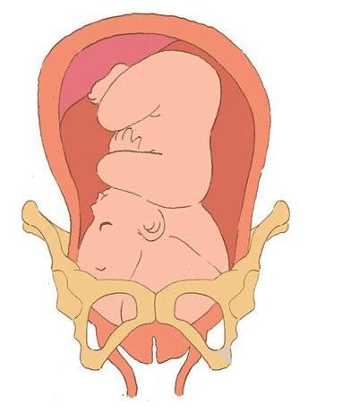 1,尿频 由于胎儿下降至盆骨,庞大的子宫会进一步压迫膀胱,膀胱难以