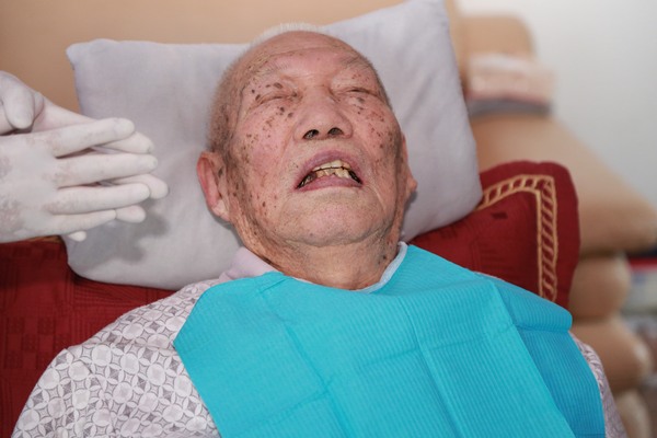 102岁老人的牙齿 你见过吗?