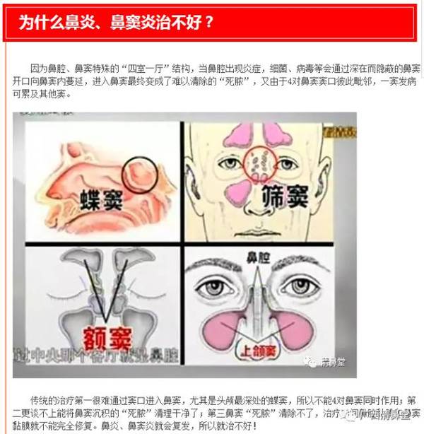 关爱鼻子,还我健康---治鼻炎,清鼻堂